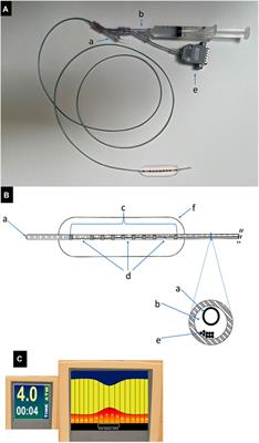 Novel venous balloon for compliance measurement and stent sizing in a post-thrombotic swine model